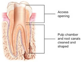 Root canal specialist in AECS Layout